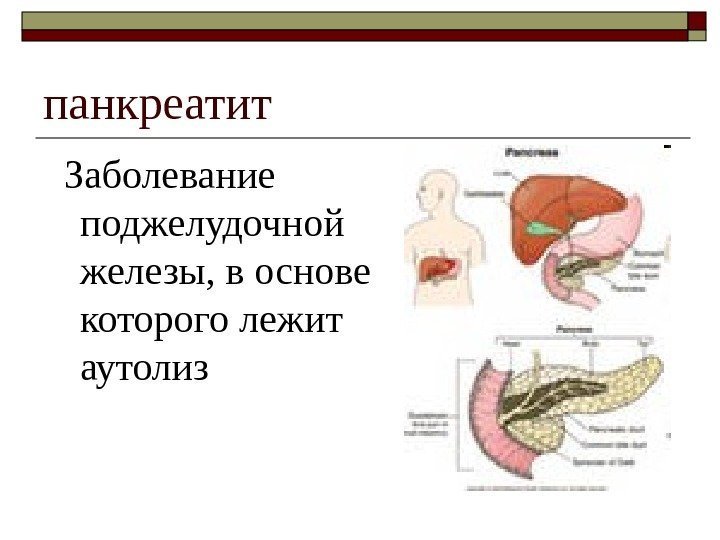   панкреатит Заболевание поджелудочной железы, в основе которого лежит аутолиз 