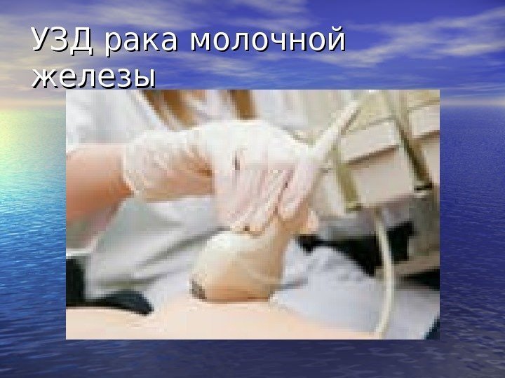   УЗД рака молочной железы 