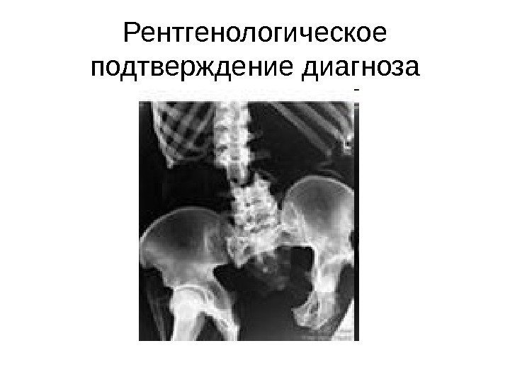 Рентгенологическое подтверждение диагноза 