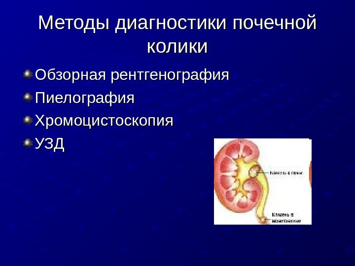   Методы диагностики почечной колики Обзорная рентгенография Пиелография Хромоцистоскопия УЗДУЗД 