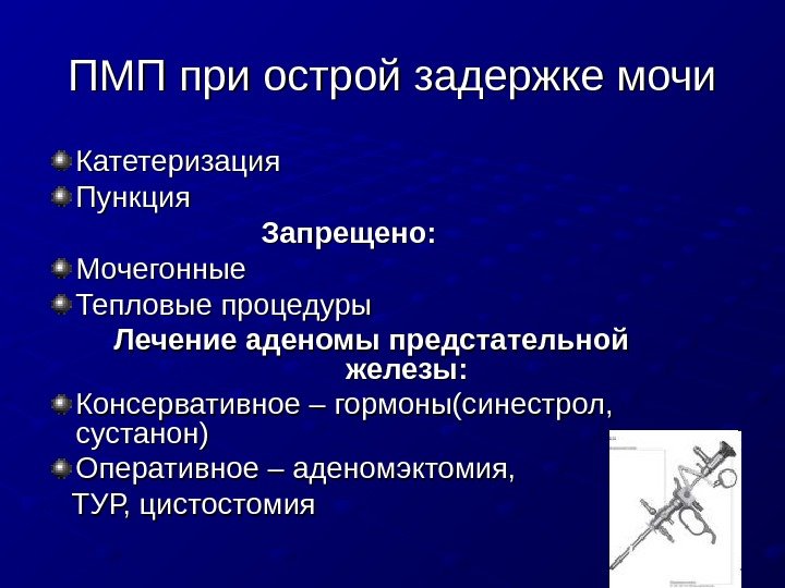   ПМП при острой задержке мочи Катетеризация Пункция     Запрещено: