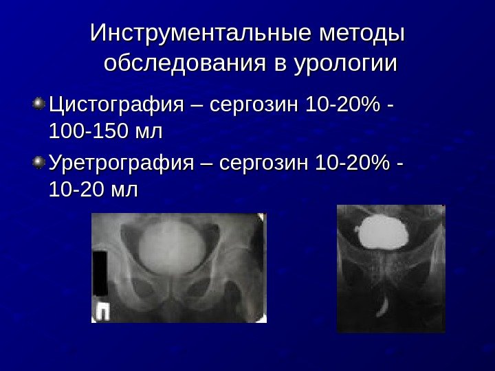   Инструментальные методы обследования в урологии Цистография – сергозин 10 -20 - 100