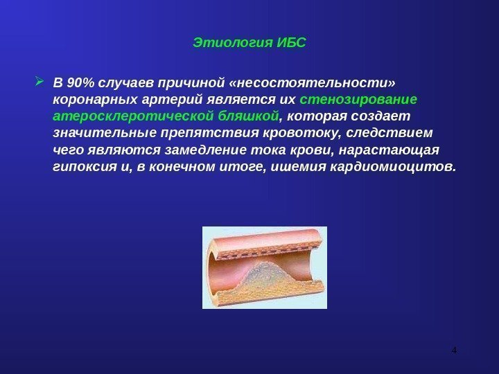 4 Этиология ИБС В 90 случаев причиной «несостоятельности»  коронарных артерий является их стенозирование