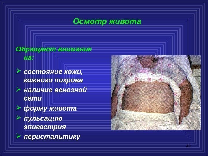 43 Осмотр живота Обращают внимание на:  состояние кожи,  кожного покрова наличие венозной