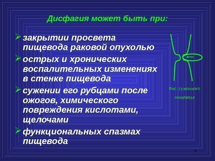 6 Дисфагия может быть при:  закрытии просвета пищевода раковой опухолью острых и хронических