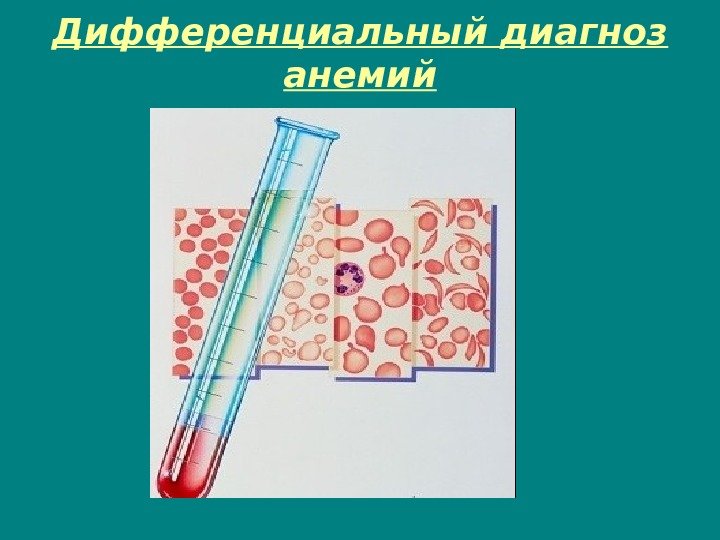 Дифференциальный диагноз анемий 