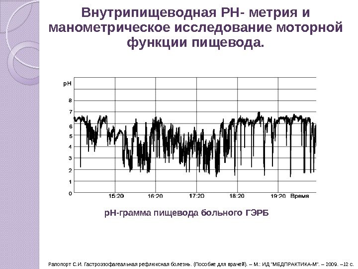р. Н-грамма пищевода больного ГЭРБ Рапопорт С. И. Гастроэзофагеальная рефлюксная болезнь. (Пособие для врачей).