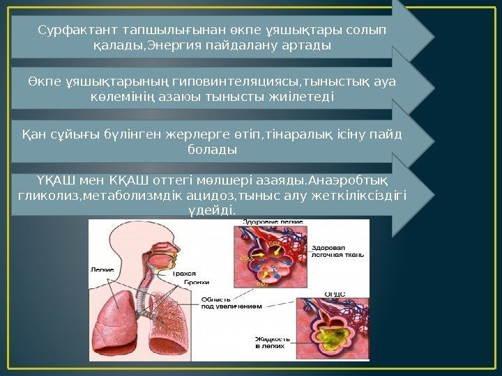 Сурфактант тапшылығынан өкпе ұяшықтары солып қалады, Энергия пайдалану артады Өкпе ұяшықтарының гиповинтеляциясы, тыныстық ауа