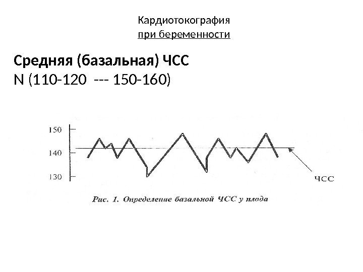 Кардиотокография при беременности Средняя (базальная) ЧСС N (110 -120 --- 150 -160) 