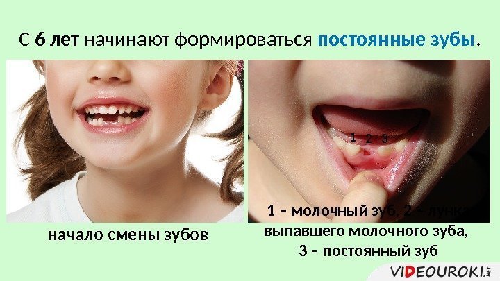 С 6 лет начинают формироваться постоянные зубы. начало смены зубов 1 – молочный зуб,