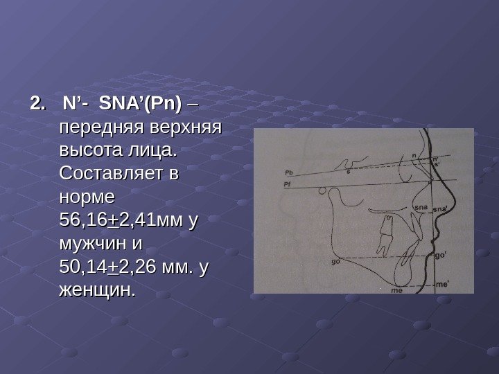 2.  2. N’-N’- SNA’(Pn) – – передняя верхняя высота лица.  Составляет в