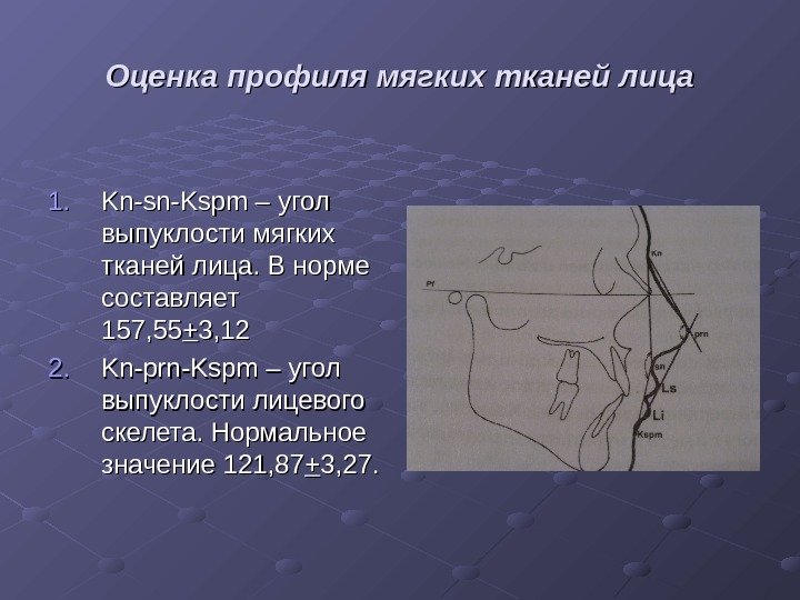 Оценка профиля мягких тканей лица  1. 1. Kn-sn-Kspm – угол выпуклости мягких тканей