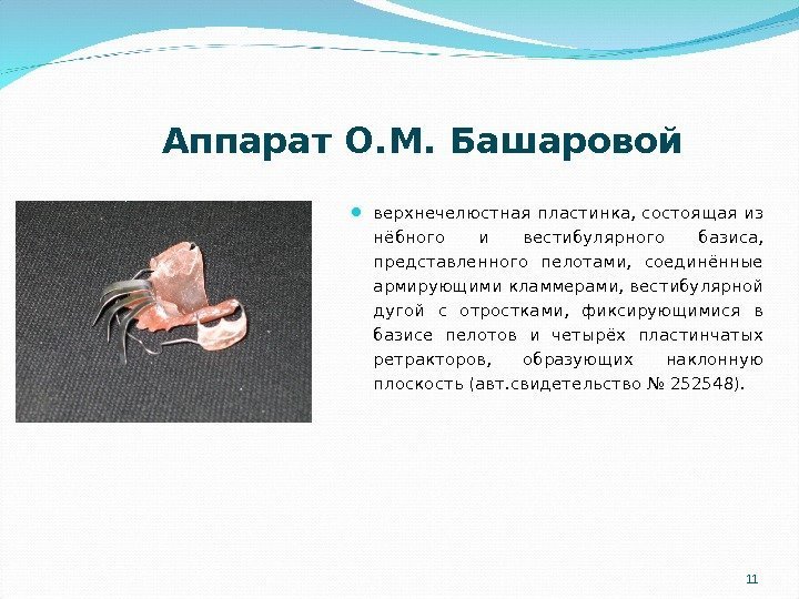 11  Аппарат О. М. Башаровой верхнечелюстная пластинка,  состоящая из нёбного и вестибулярного
