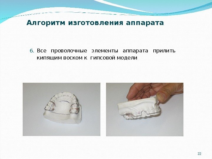 226. Все проволочные элементы аппарата прилить кипящим воском к гипсовой модели. Алгоритм изготовления аппарата