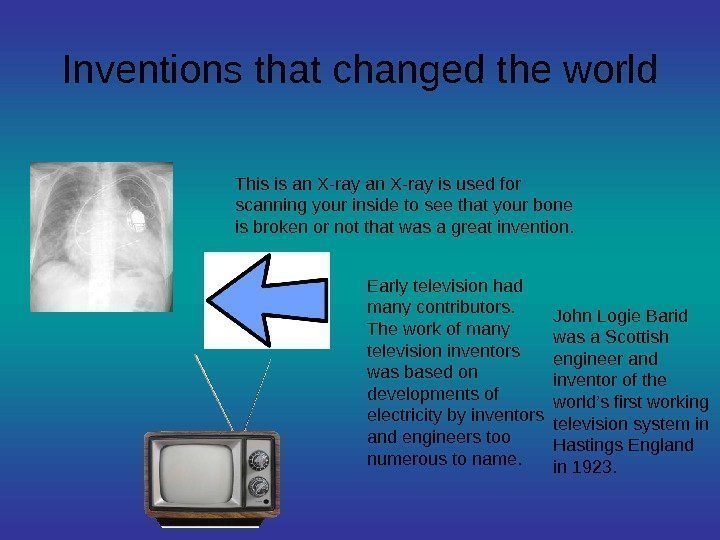   Inventions that changed the world This is an X-ray is used for