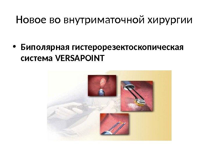 Новое во внутриматочной  хирургии • Биполярная  гистерорезектоскопическая система  VERSAPOINT 