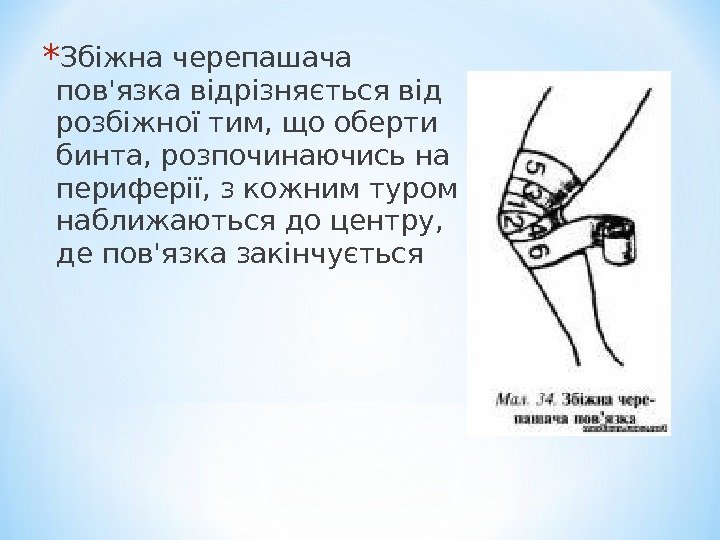 * Збіжна черепашача пов'язка відрізняється від розбіжної тим, що оберти бинта, розпочинаючись на периферії,