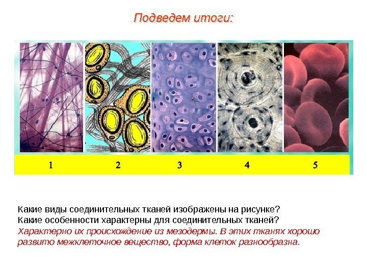 Какие виды соединительных тканей изображены на рисунке? Какие особенности характерны для соединительных тканей? Характерно