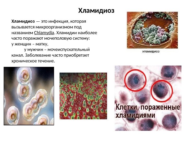 Хламидиоз — это инфекция, которая вызывается микроорганизмом под названием Chlamydia. Хламидии наиболее часто поражают