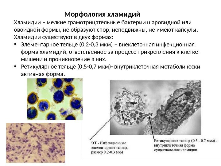 Морфология хламидий Хламидии – мелкие грамотрицательные бактерии шаровидной или овоидной формы, не образуют спор,