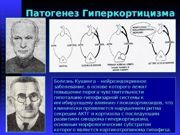 Патогенез Гиперкортицизма Болезнь Кушинга – нейроэндокринное заболевание, в основе которого лежит повышение порога чувствительности