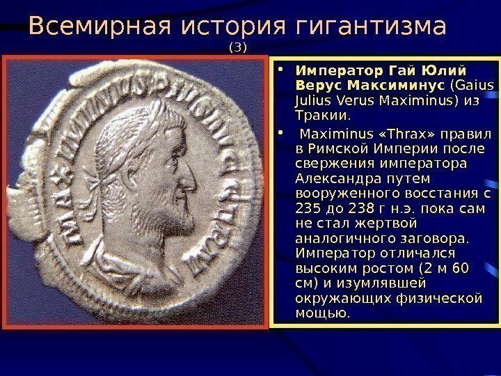   Всемирная история гигантизма (3) • Император Гай Юлий Верус Максиминус ( Gaius