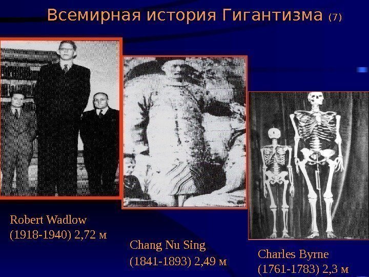   Всемирная история Гигантизма (7) Robert Wadlow (1918 -1940) 2, 72 м Chang