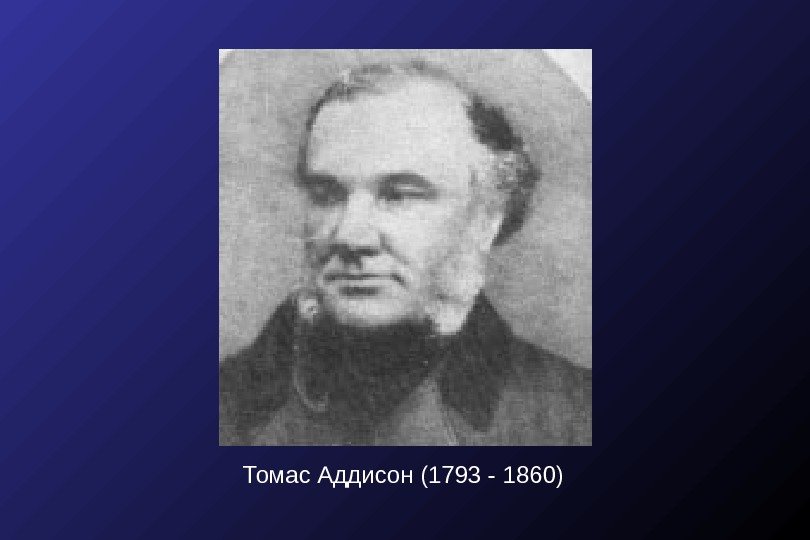 Томас Аддисон (1793 - 1860) 