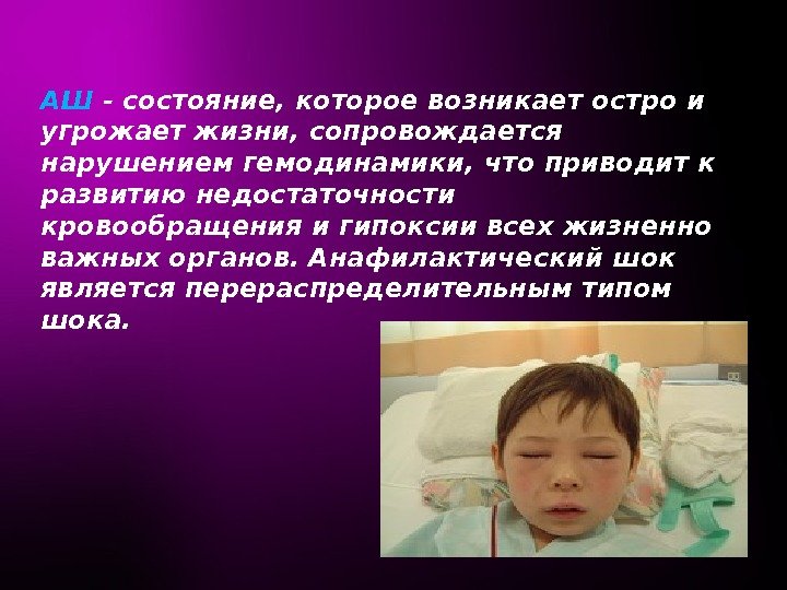 АШ  - состояние, которое возникает остро и угрожает жизни, сопровождается нарушением гемодинамики, что