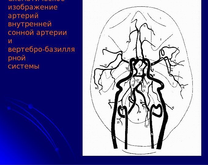 Схематическое изображение артерий внутренней сонной артерии  и вертебро-базилля рной системы 
