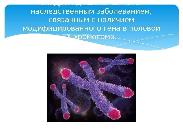 Синдром Дюшена является наследственным заболеванием,  связанным с наличием модифицированного гена в половой Х-хромосоме.