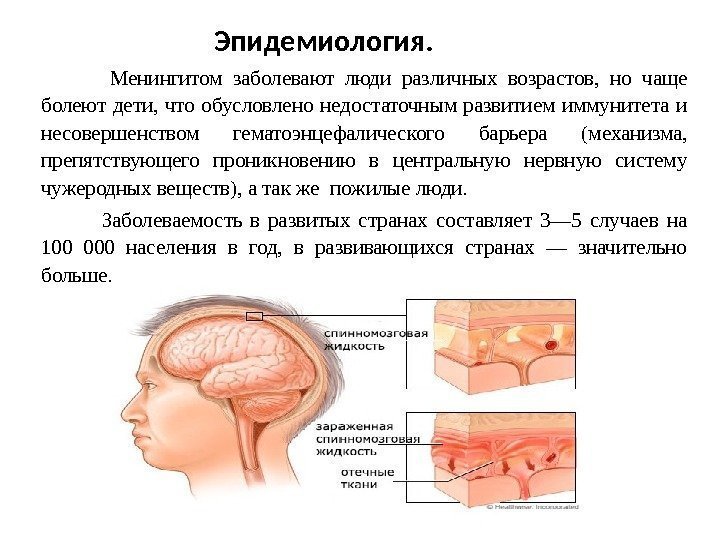      Эпидемиология.  Менингитом заболевают люди различных возрастов,  но