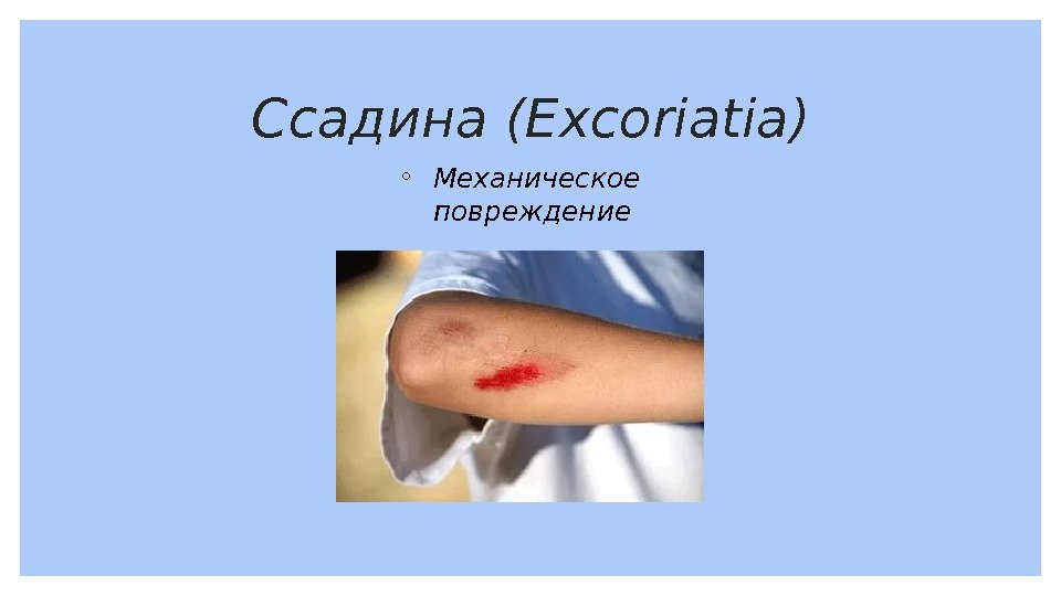 Ссадина (Excoriatia) ◦ Механическое повреждение 