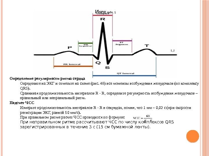 Определение регулярности ритма сердца Определите на ЭКГ и отметьте на схеме (рис. 48) все