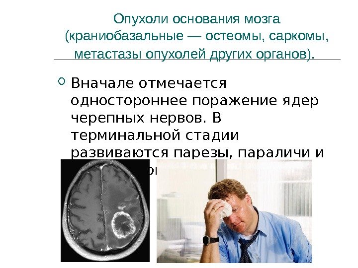 Опухоли основания мозга (краниобазальные — остеомы, саркомы,  метастазы опухолей других органов). Вначале отмечается
