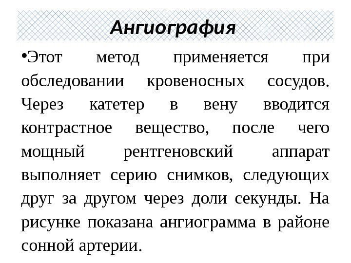  • Этот метод применяется при обследовании кровеносных сосудов.  Через катетер в вену