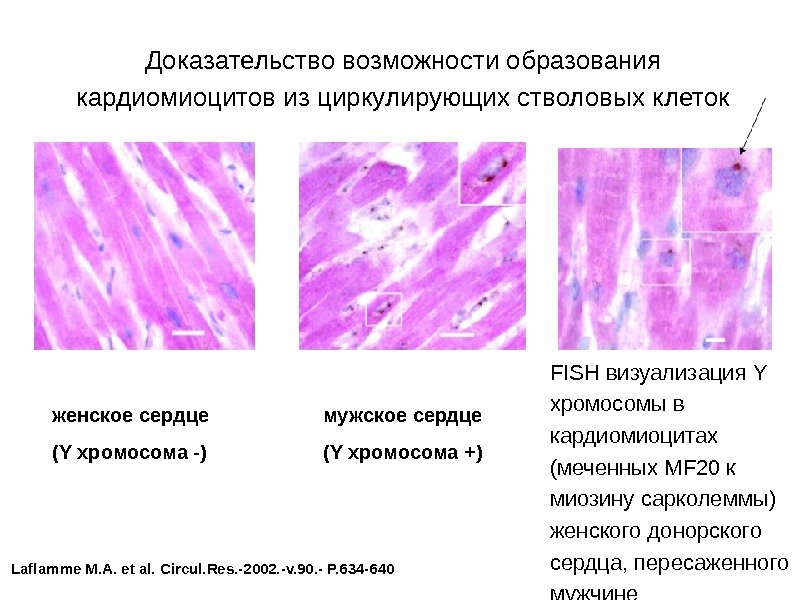 Доказательство возможности образования кардиомиоцитов из циркулирующих стволовых клеток FISH визуализация Y хромосомы в кардиомиоцитах