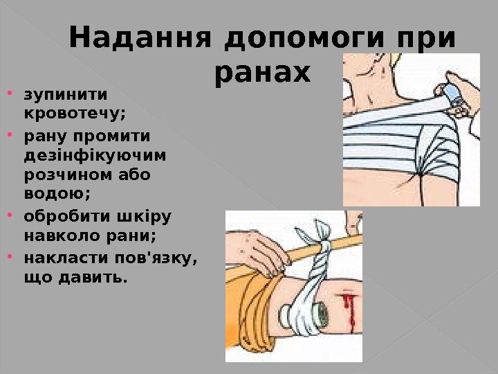 Надання допомоги при ранах зупинити кровотечу;  рану промити дезінфікуючим розчином або водою; 