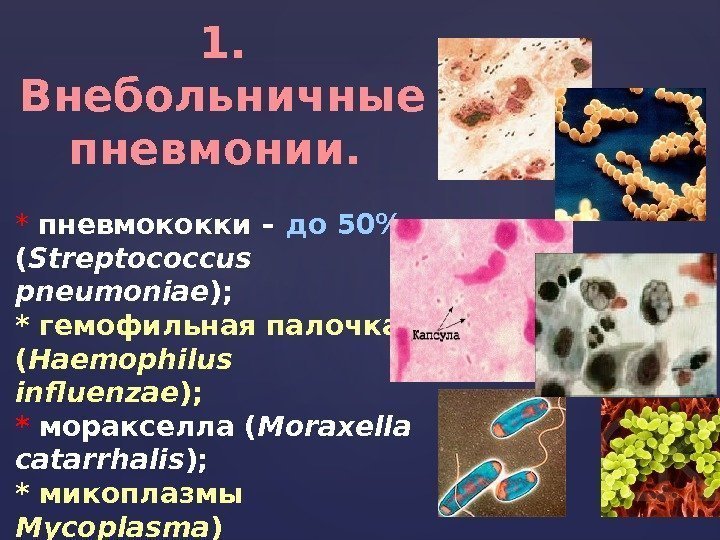 1.  Внебольничные пневмонии.  *  пневмококки – до 50 ( Streptococcus pneumoniae