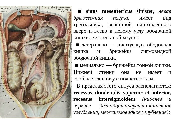  ■  sinus mesentericus sinister,  левая  брыжеечная  пазуха , 