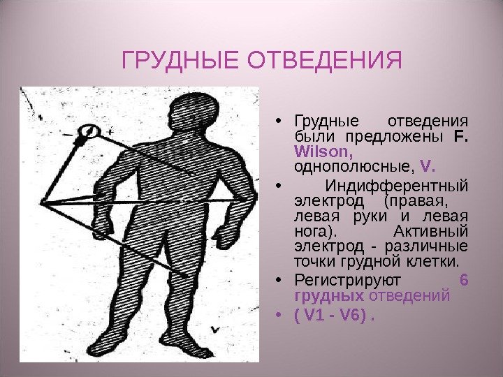 ГРУДНЫЕ ОТВЕДЕНИЯ  • Грудные отведения были предложены F.  Wilson ,  однополюсные,