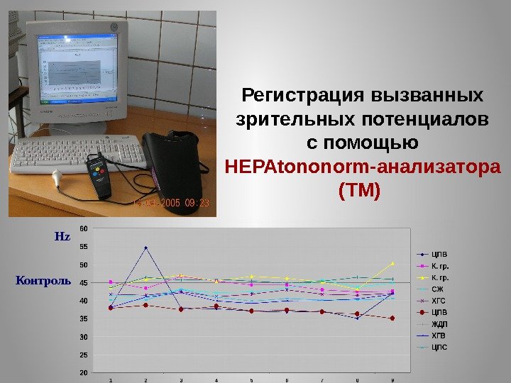 Регистрация вызванных зрительных потенциалов с помощью НЕРАtononorm-анализатора (ТМ) Hz Hz Контроль 