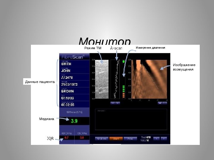 Монитор Информационные процессы Измерение давления Данные пациента Медиана Режим TM Изображение возмущения 