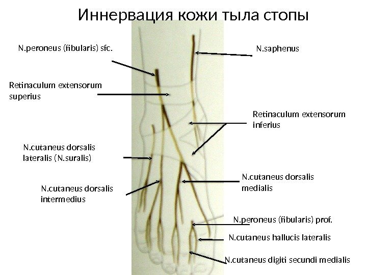 Иннервация кожи тыла стопы Retinaculum extensorum superius Retinaculum extensorum inferius N. saphenus. N. peroneus