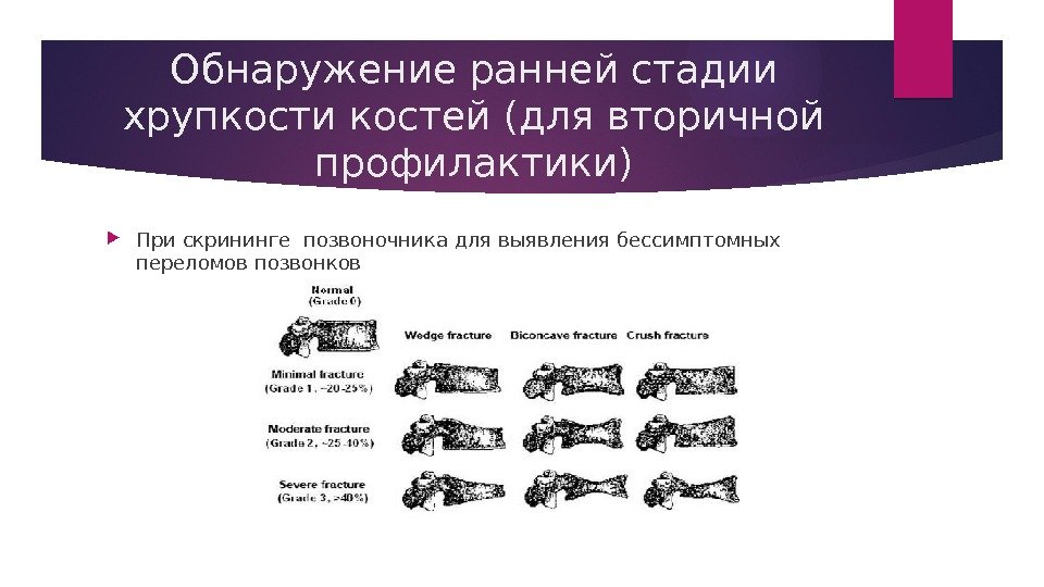 Обнаружение ранней стадии хрупкости костей (для вторичной профилактики) При скрининге позвоночника для выявления бессимптомных