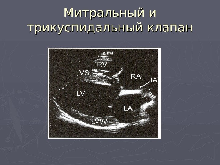   Митральный и трикуспидальный клапан 