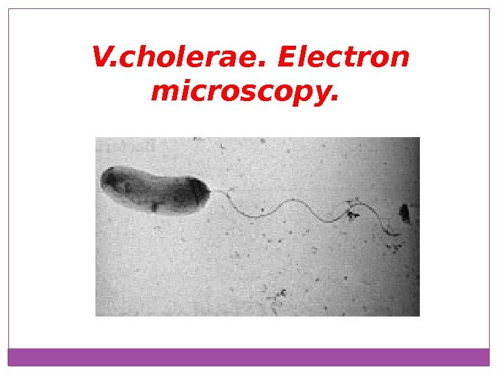 V. cholerae. Electron microscopy.  