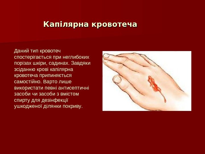 Капілярна кровотеча Даний тип кровотеч спостерігається при неглибоких порізах шкіри, садинах. Завдяки зсіданню крові