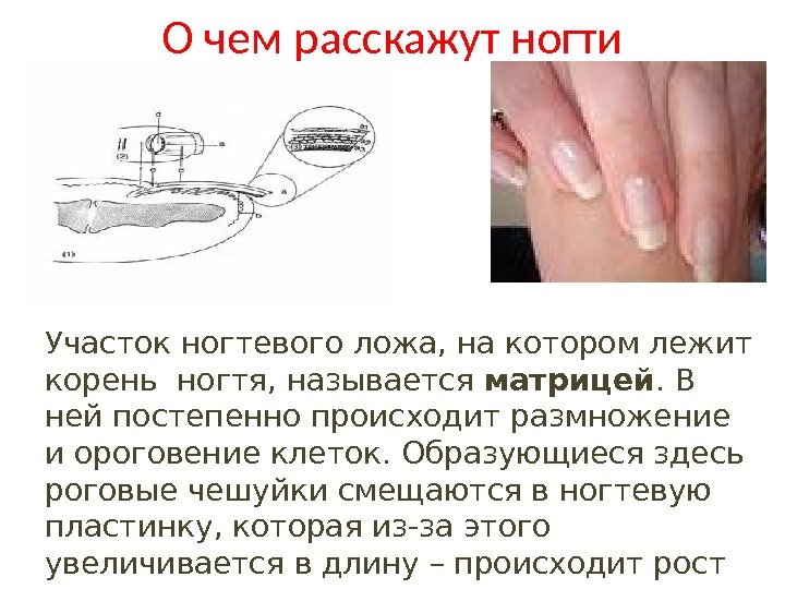 О чем расскажут ногти Участок ногтевого ложа, на котором лежит корень ногтя, называется матрицей.