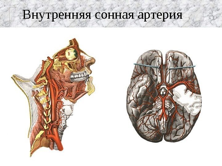   Внутренняя сонная артерия  